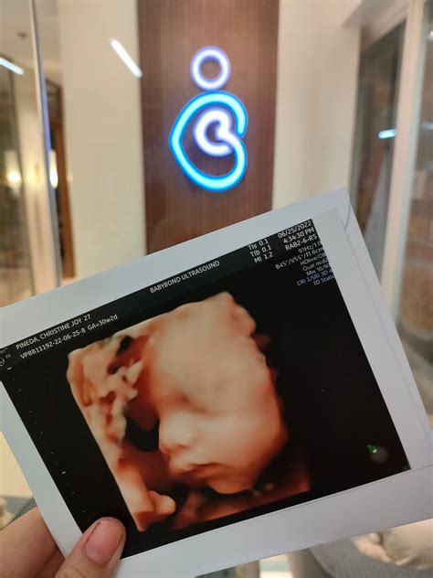 live quezon 4d|Babybond Ultrasound .
